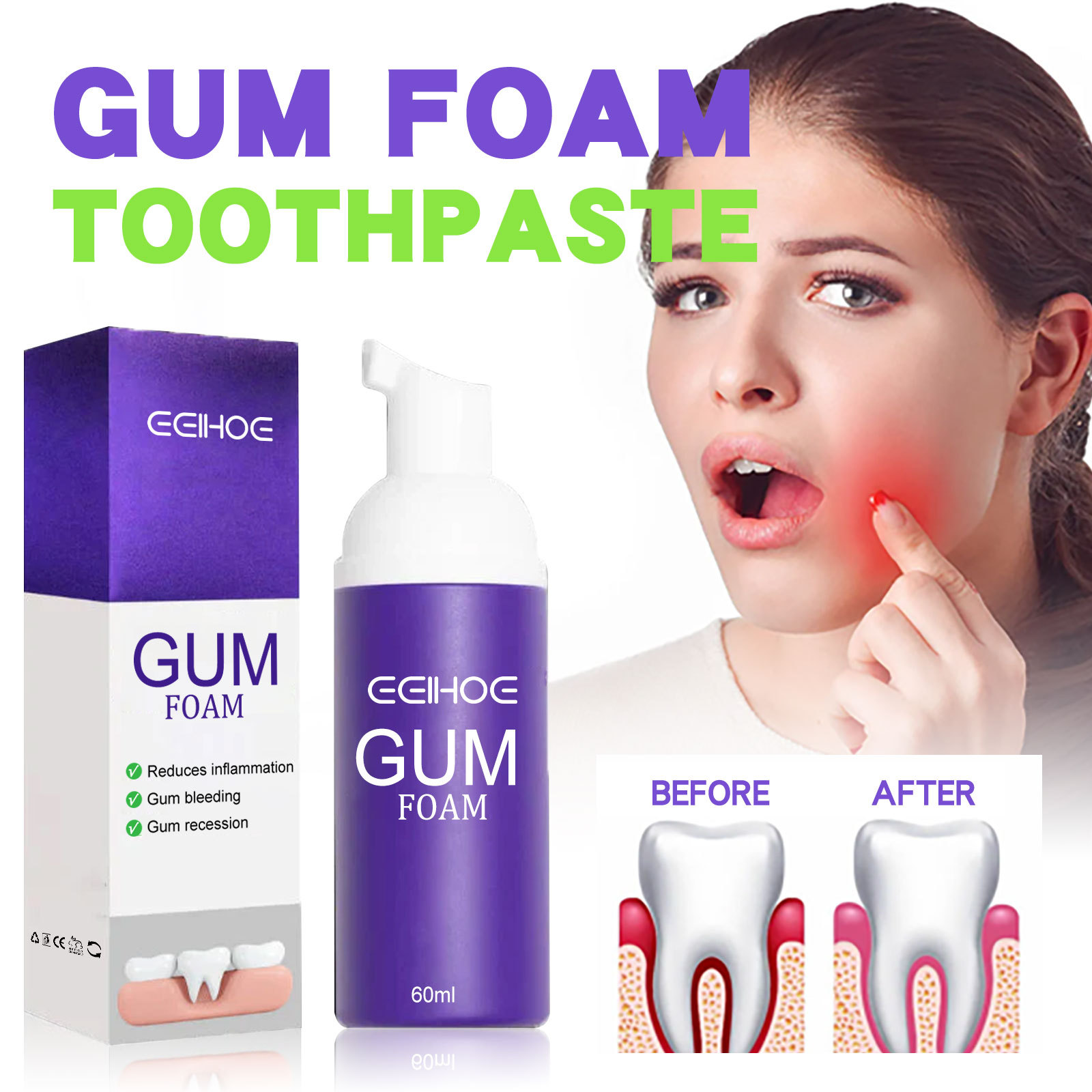 Teeth Whitening Treatment - 60ml Teeth Whitening Mousse V34 Teeth