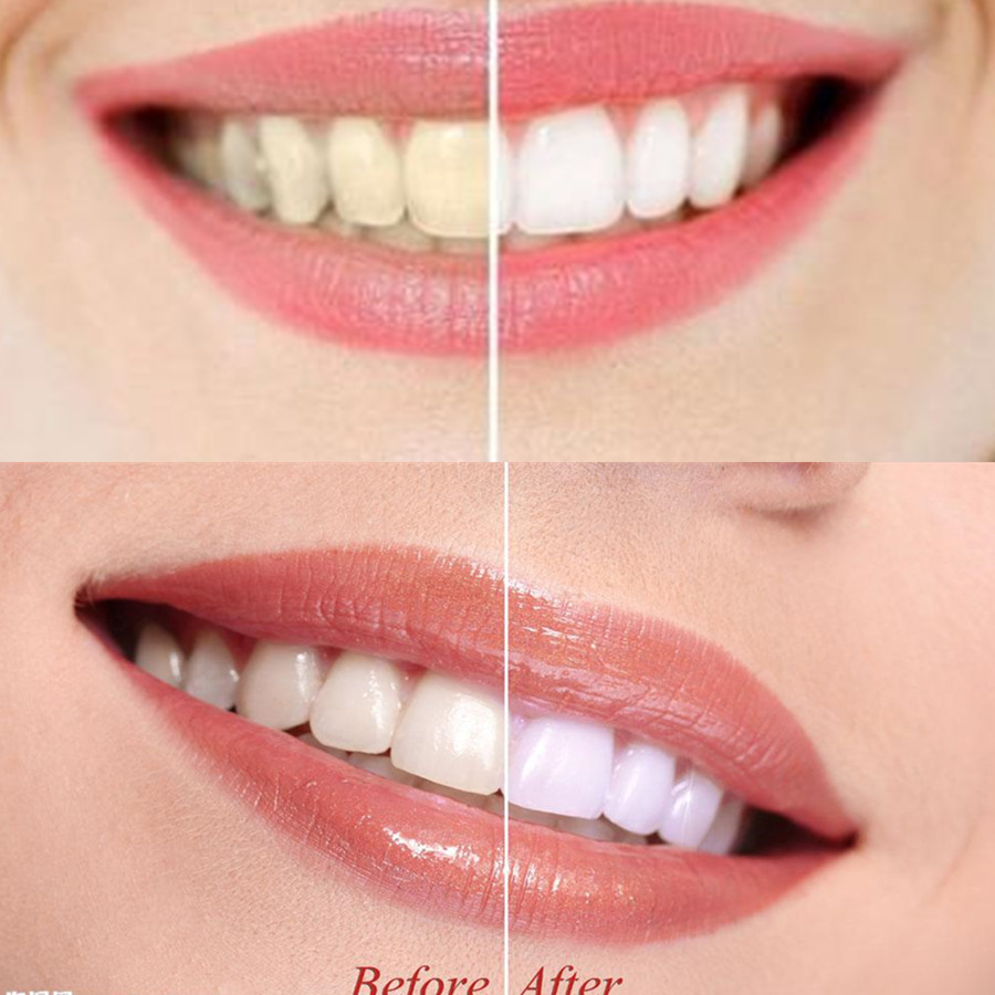 Bamboo Charcoal Teeth Tooth De - Teeth Whitening Flash recension och pris