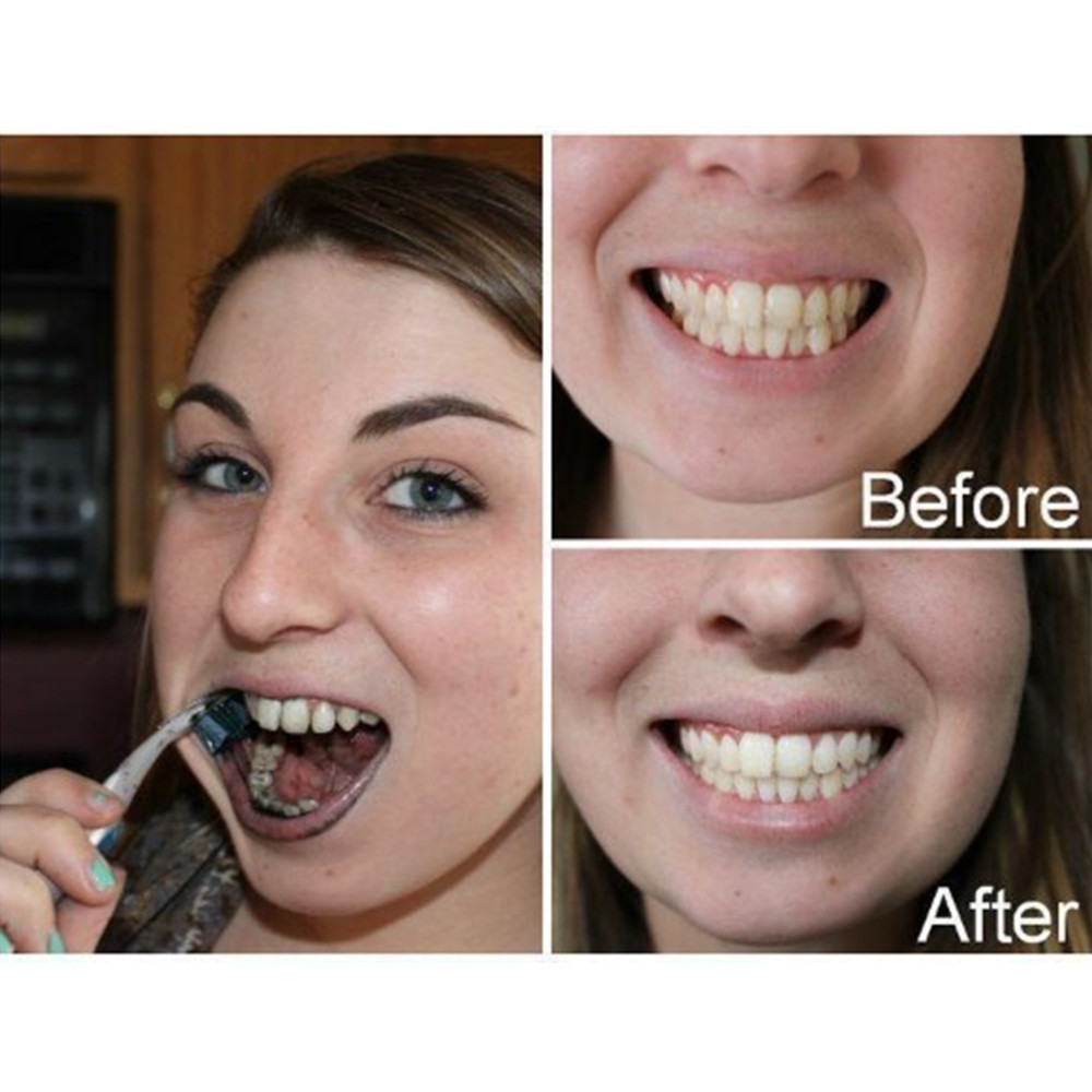 Bamboo Charcoal Teeth Tooth De - Teeth Whitening Flash recension och pris