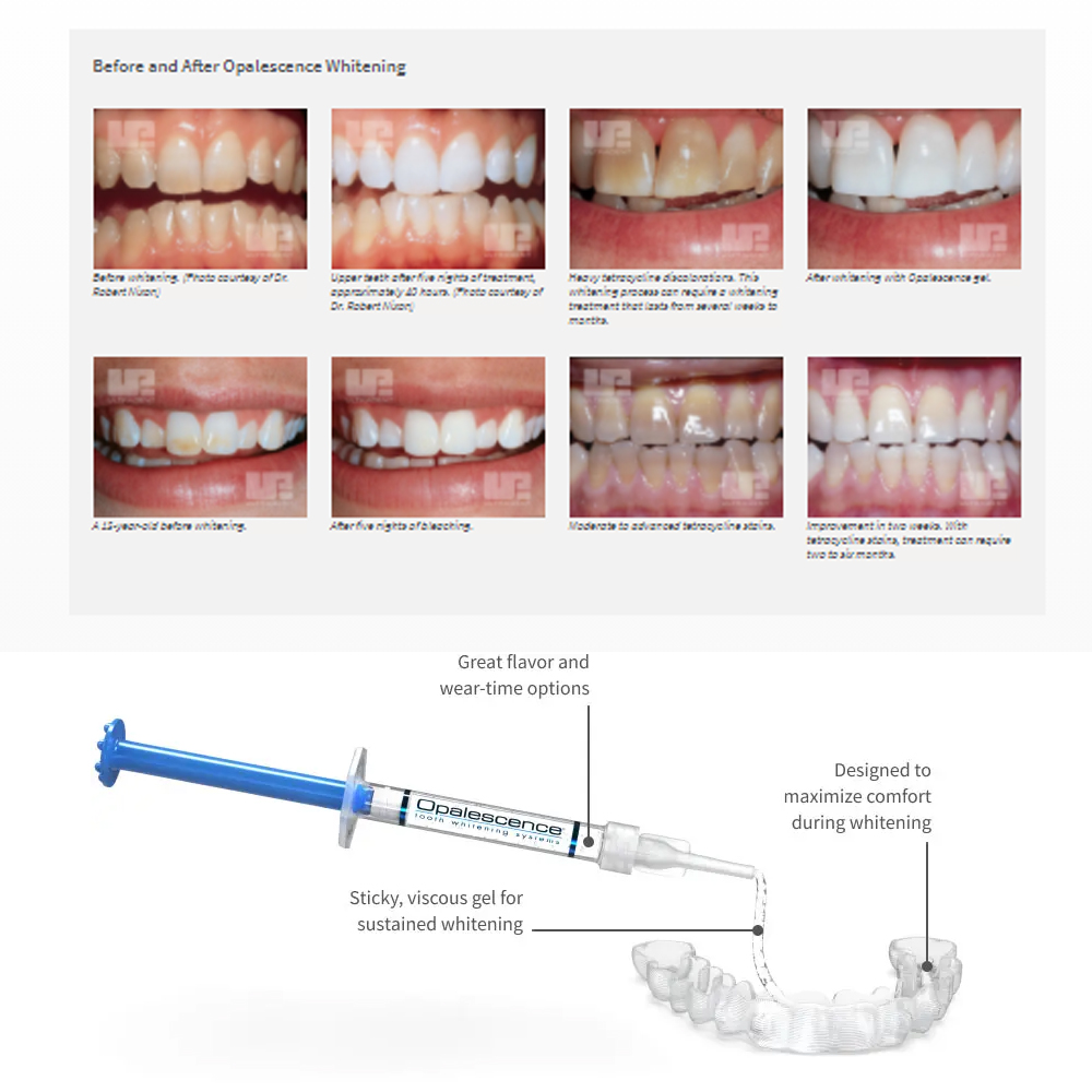 Opalescence Whitening 20% PF 2 - Teeth Whitening With Peroxide recension och pris