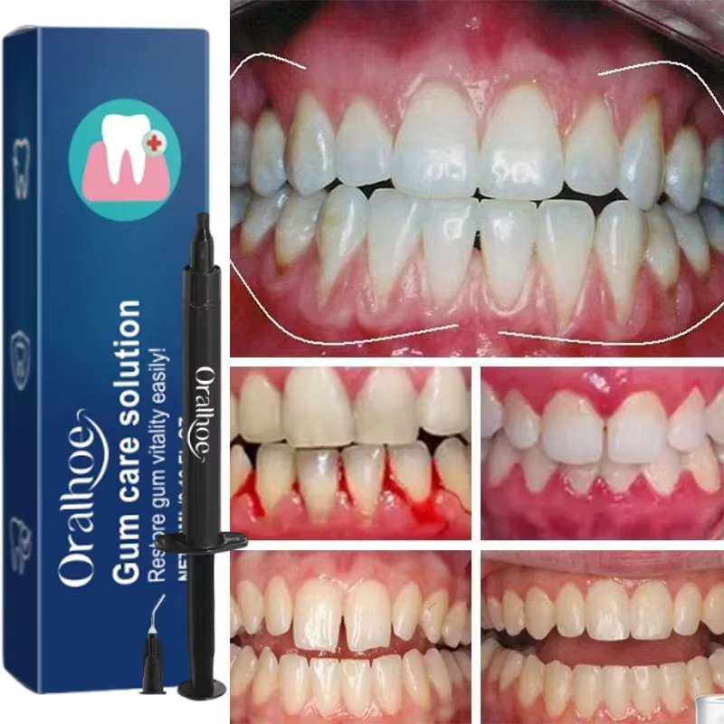 Teeth Whitening Gel Gum Repair - Teeth Whitening Gels recension och pris
