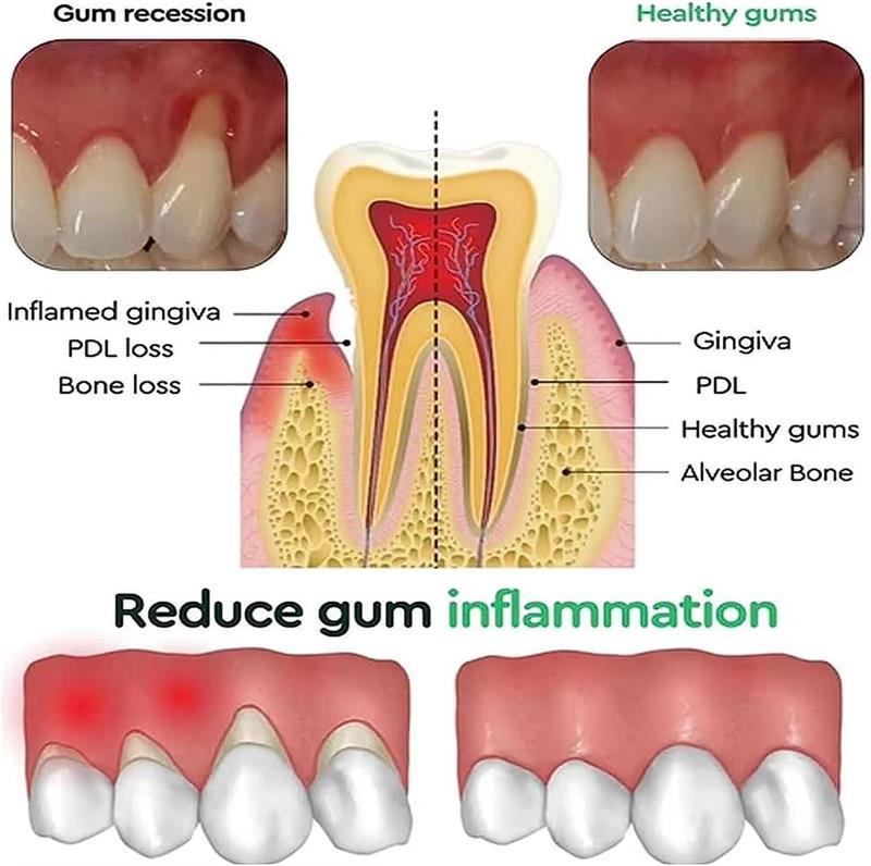 Teeth Whitening Gel Gum Repair - Teeth Whitening Gels recension och pris