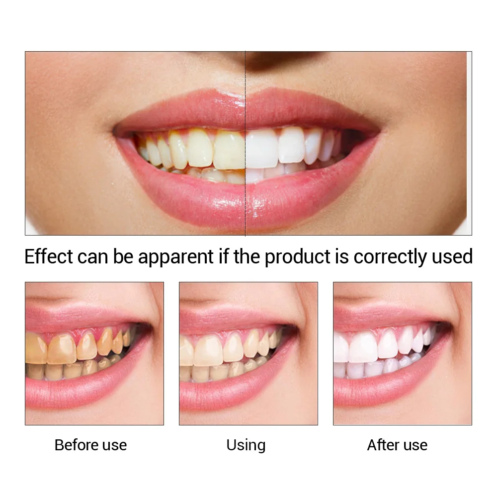 FTEENPLY Teeth Whitening Essen - Teeth Whitening Flash recension och pris