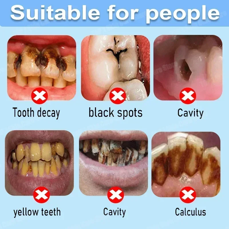 Anti Decay Toothpaste Repairs  - Teeth Whitening Treatment recension och pris