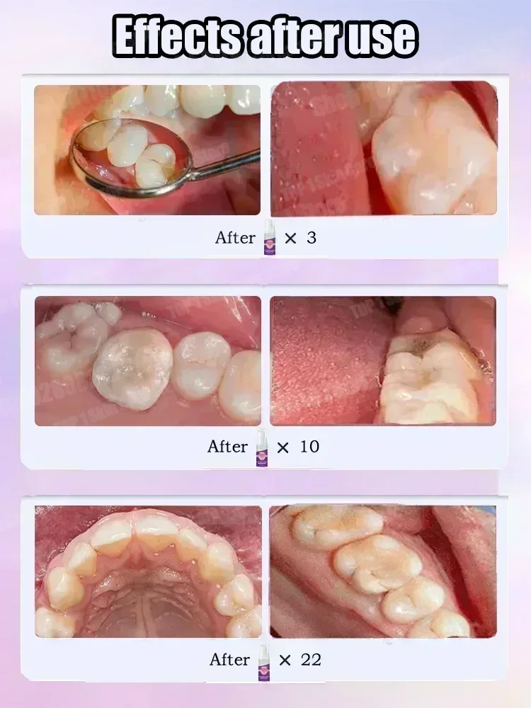 Hot sales Best-selling, Scient - Teeth Whitening Treatment recension och pris