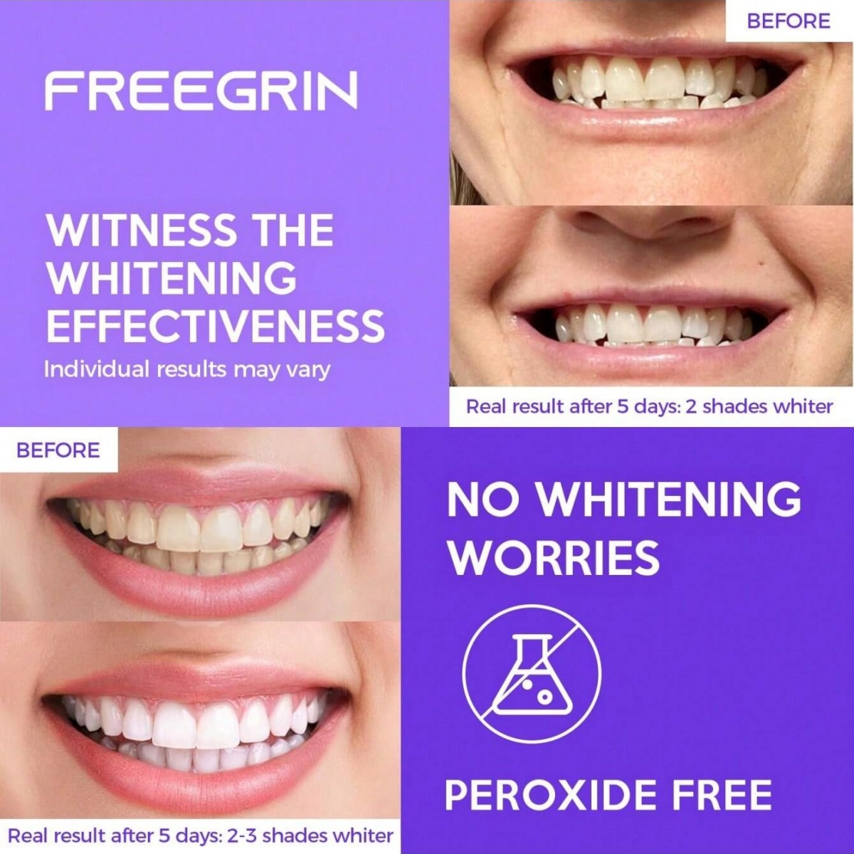 Deluxe Whitening Teeth Sticker - Teeth Whitening Ai recension och pris
