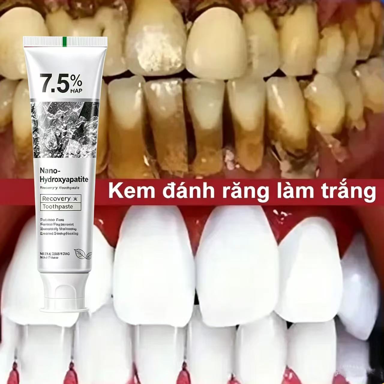 7.5% Hydroxyapatite Probiotic  - Teeth Whitening Treatment recension och pris