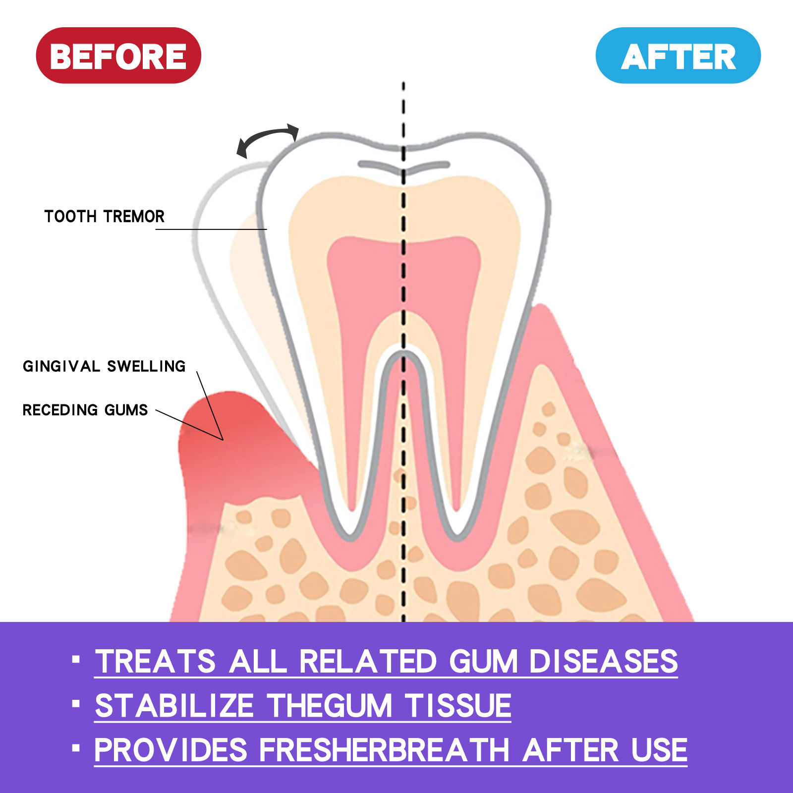 60ml Teeth Whitening Mousse V3 - Teeth Whitening Treatment recension och pris