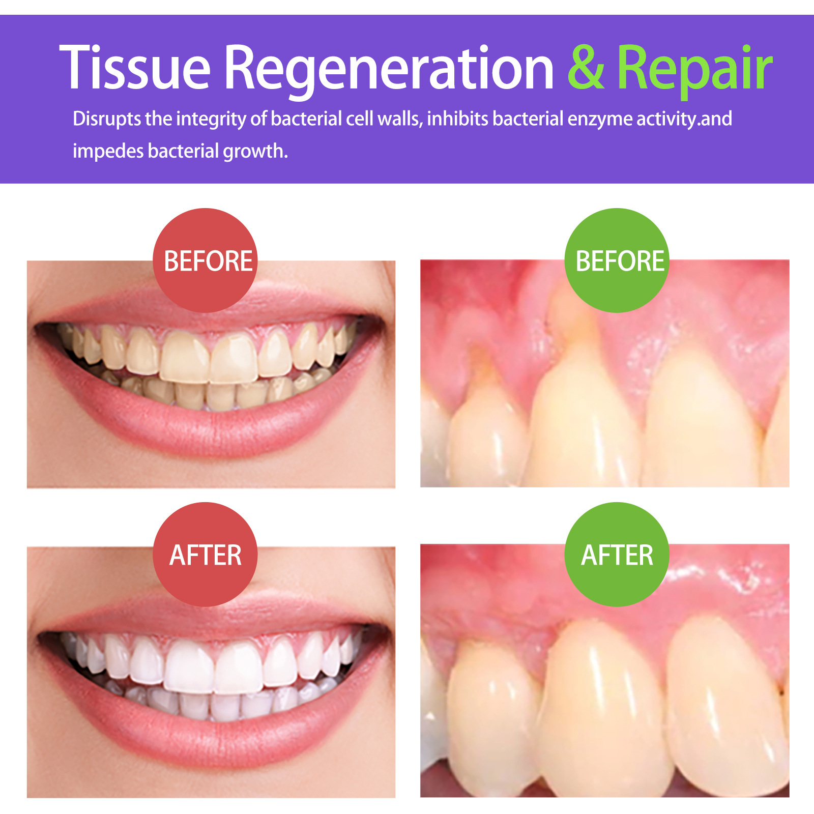 60ml Teeth Whitening Mousse V3 - Teeth Whitening Treatment recension och pris
