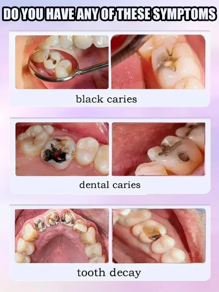 Teeth Cleaning Toothpaste Remo - Teeth Whitening Treatment recension och pris
